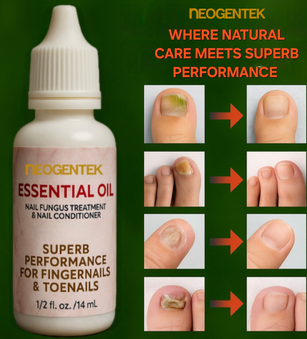Neogentek Essential Oil Fight Nail Fungus I Made in USA | Pure Natural Ingredients I Ultimate Strength Superb Performance | Promotes Healthy Nail | Renew | Restore Weak & Discolored Nails 14 ML