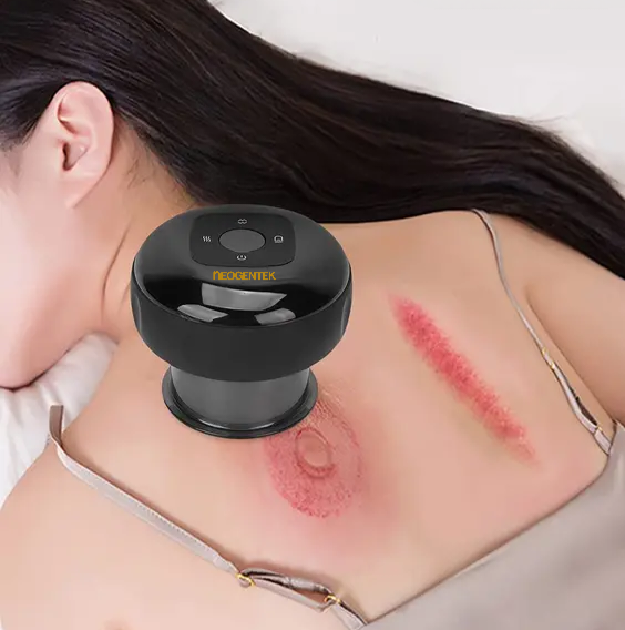 Neogentek Smart Cupping Device