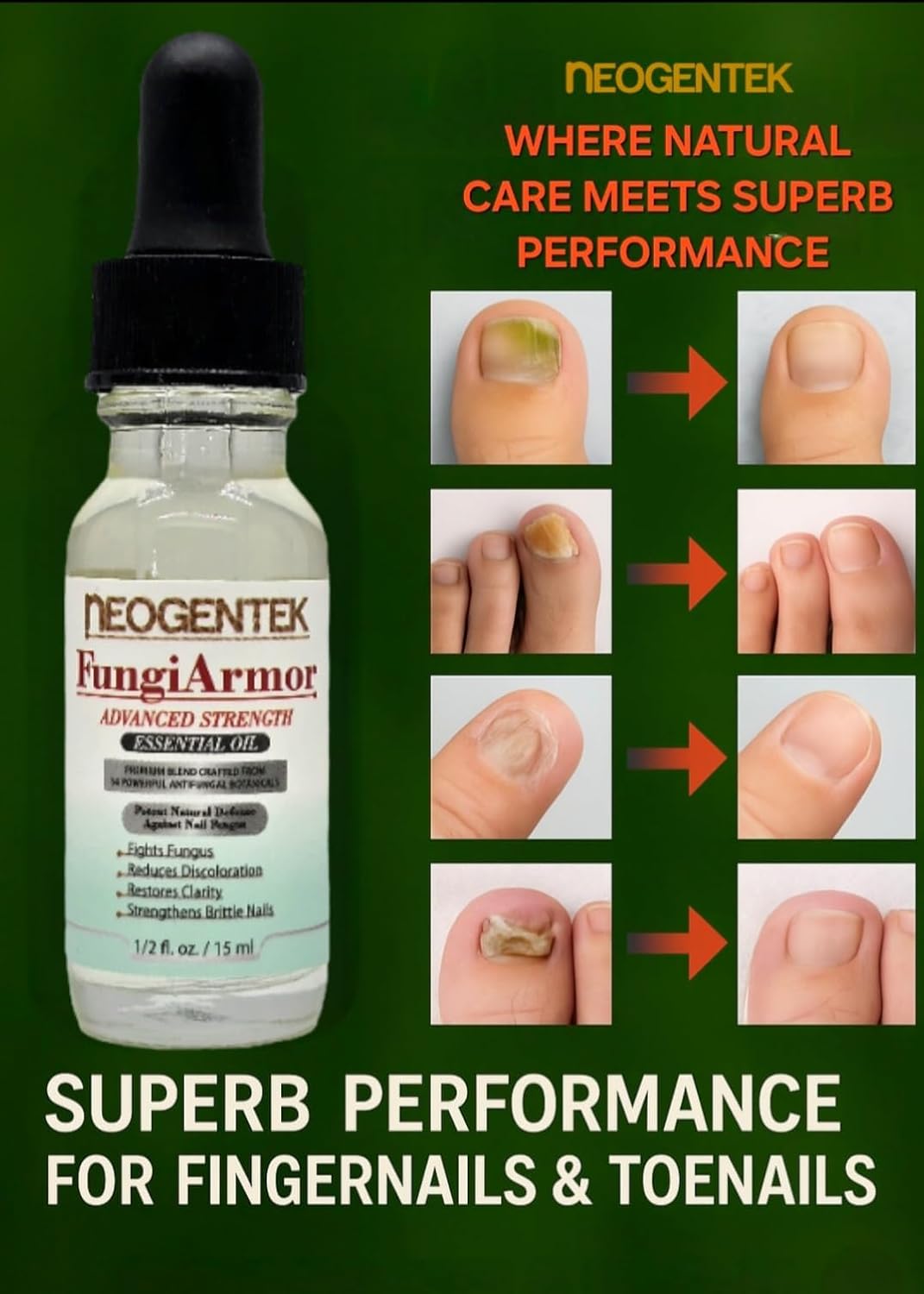 Neogentek FungiAmor -  Nail Fungus Treatment -  Made in USA - 15ML