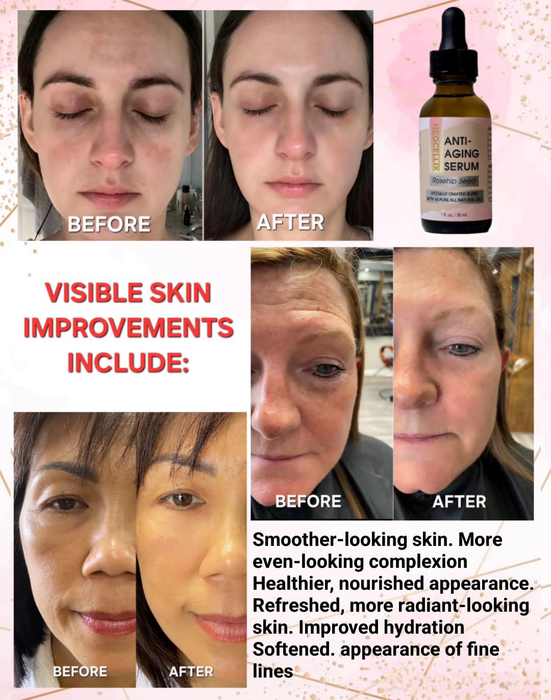 Anti-Aging Oil Serum | Made in Usa - 1 Fl Oz
