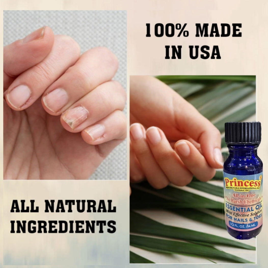 Princess By Neogentek Essential Oil Fight Nail Fungus /Promotes Healthy Nail Renewal & Strengthener/Restore Weak & Discolored Nail