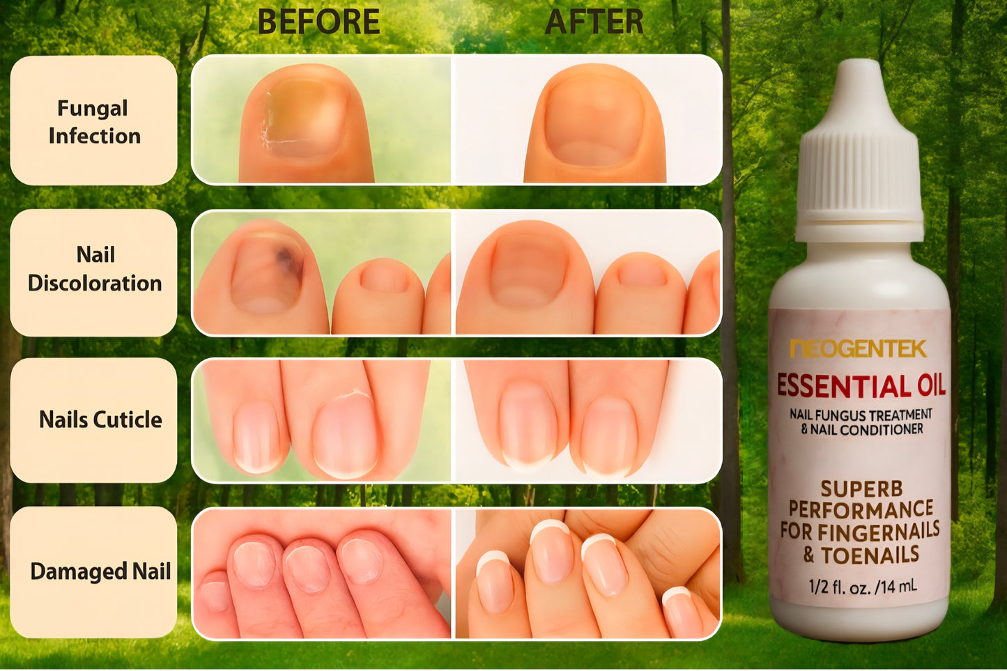 Neogentek Essential Oil Fight Nail Fungus I Made in USA | Pure Natural Ingredients I Ultimate Strength Superb Performance | Promotes Healthy Nail | Renew | Restore Weak & Discolored Nails 14 ML