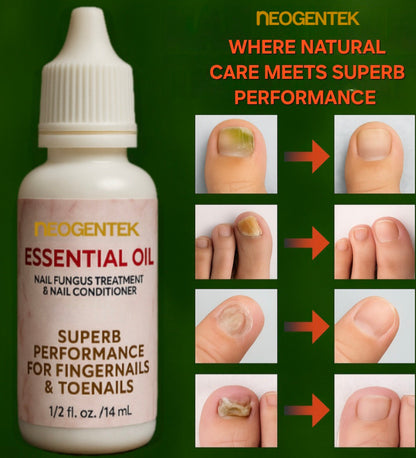 Neogentek Essential Oil Fight Nail Fungus I Made in USA | Pure Natural Ingredients I Ultimate Strength Superb Performance | Promotes Healthy Nail | Renew | Restore Weak & Discolored Nails 14 ML