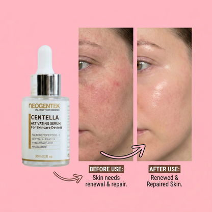 Neogentek Centella Activating Serum