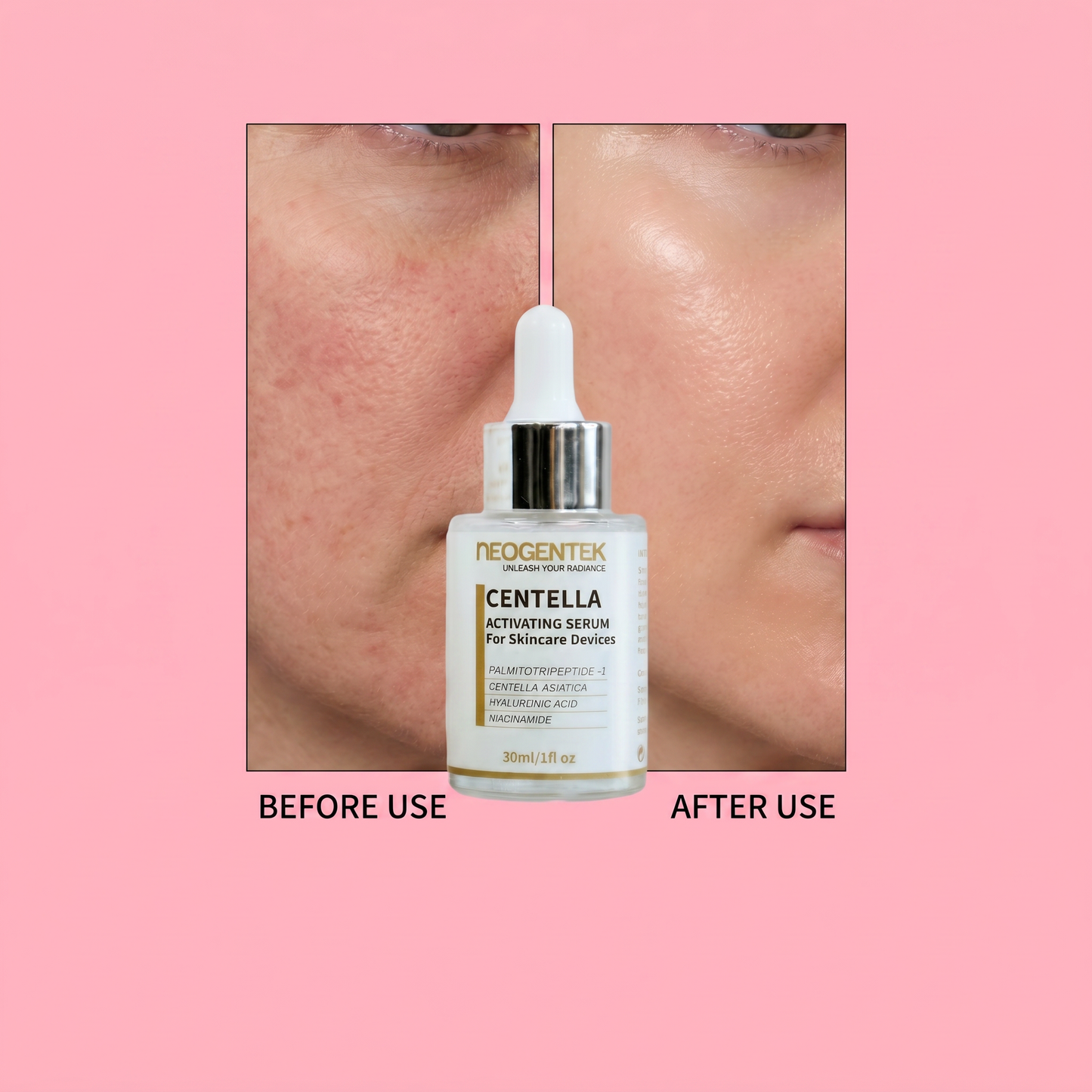 Neogentek Centella Activating Serum