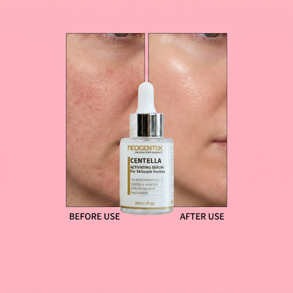 Neogentek Centella Activating Serum